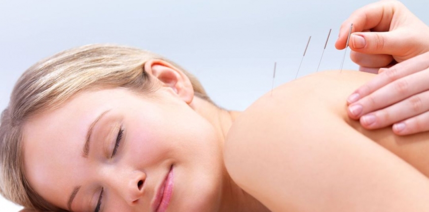 Health benefits of Acupuncture